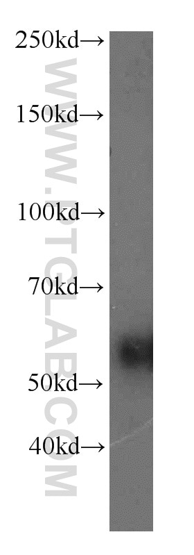 Western Blot (WB) analysis of mouse pancreas tissue using RAMP3 Polyclonal antibody (11861-1-AP)