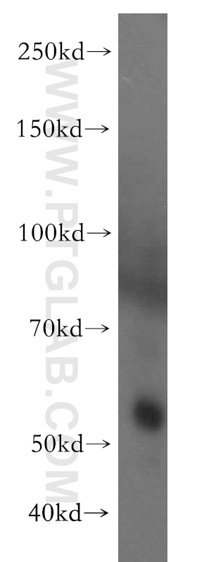 Western Blot (WB) analysis of human placenta tissue using RAMP3 Polyclonal antibody (11861-1-AP)