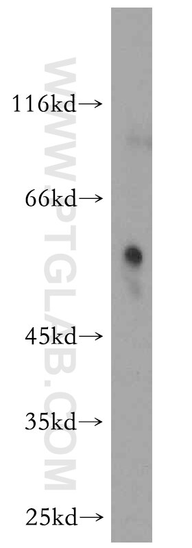 Western Blot (WB) analysis of human heart tissue using RAMP3 Polyclonal antibody (11861-1-AP)