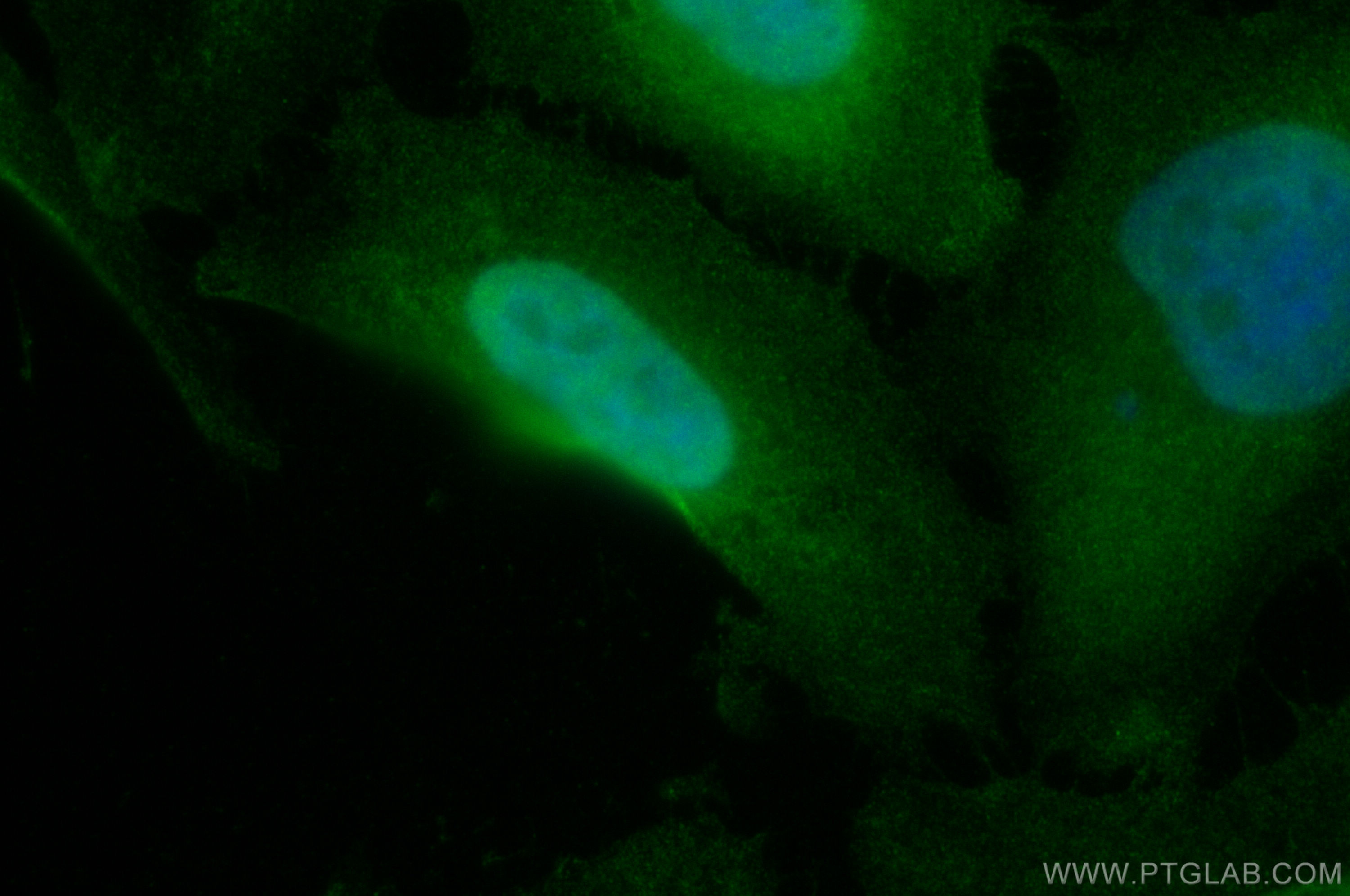 Immunofluorescence (IF) / fluorescent staining of HeLa cells using RAN Polyclonal antibody (10469-1-AP)