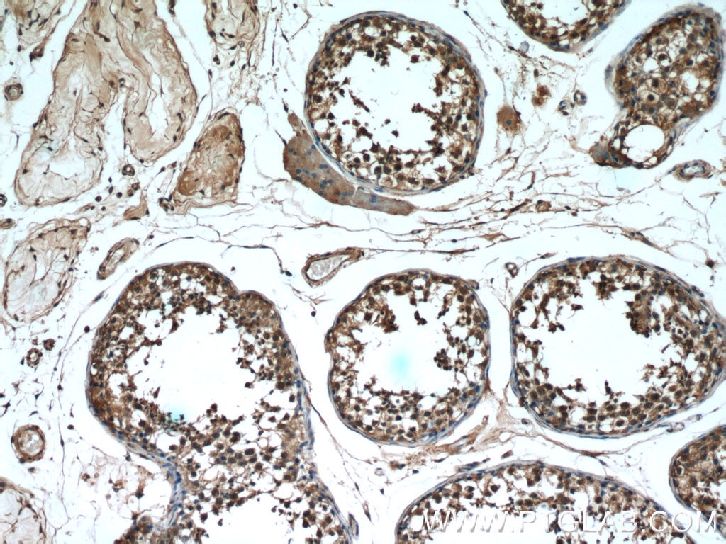 Immunohistochemistry (IHC) staining of human testis tissue using RAN Polyclonal antibody (10469-1-AP)