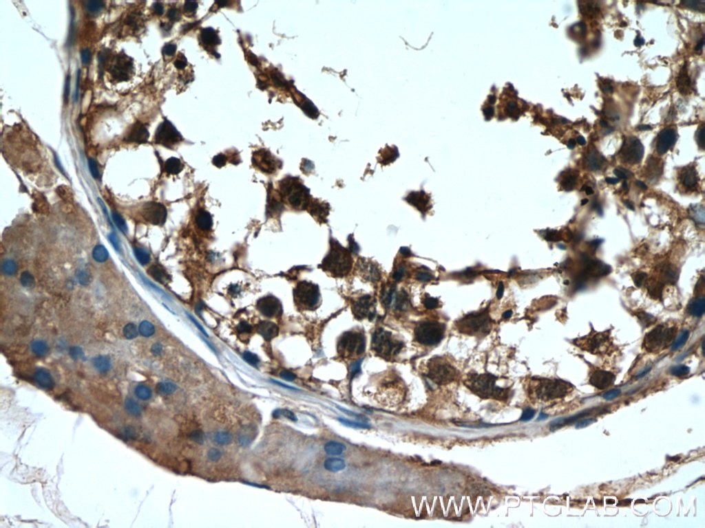 Immunohistochemistry (IHC) staining of human testis tissue using RAN Polyclonal antibody (10469-1-AP)