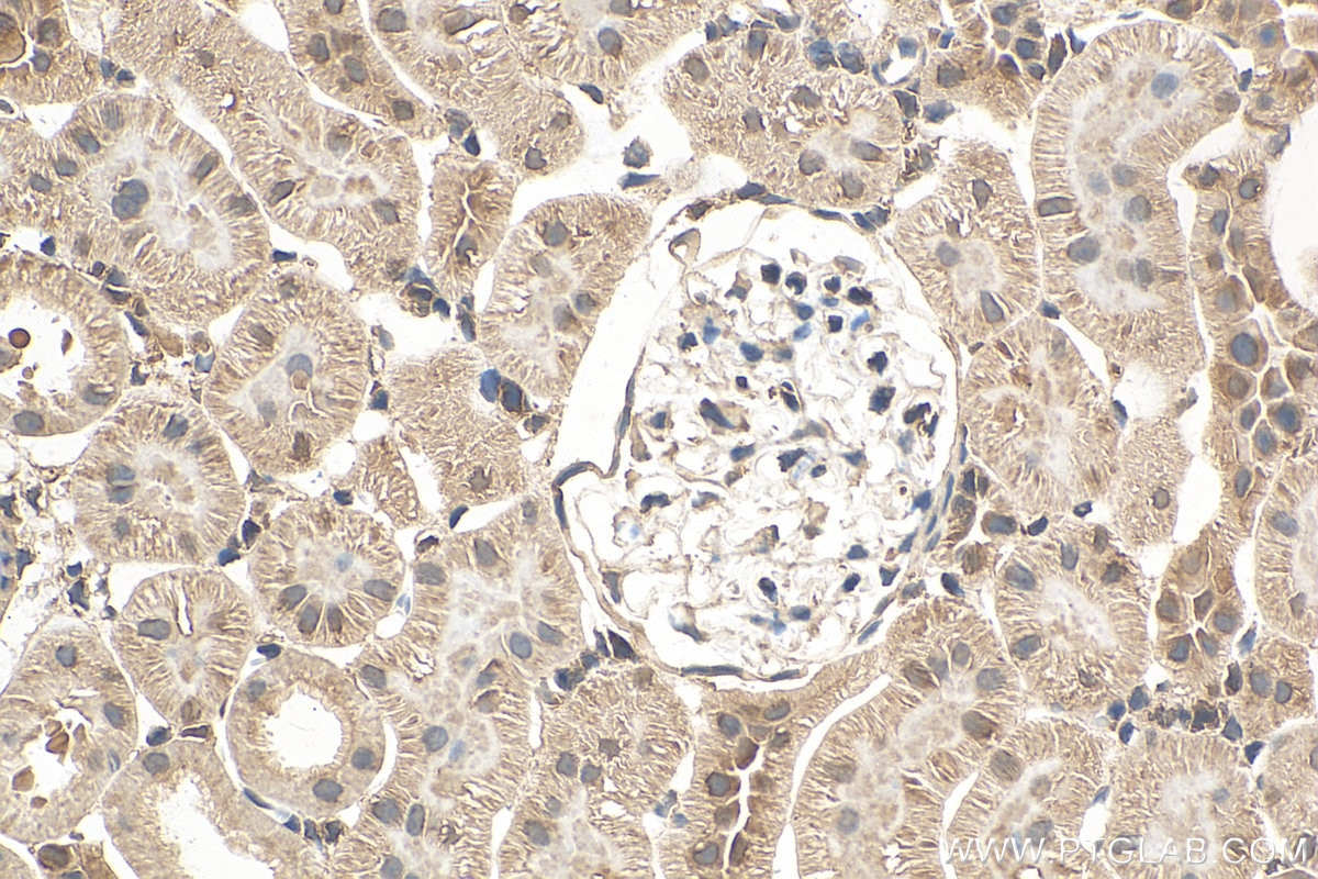 Immunohistochemistry (IHC) staining of rat kidney tissue using RAN Polyclonal antibody (10469-1-AP)