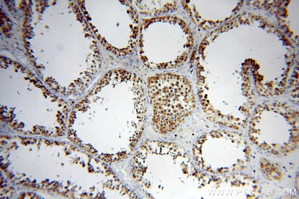 Immunohistochemistry (IHC) staining of human testis tissue using RAN Polyclonal antibody (10469-1-AP)