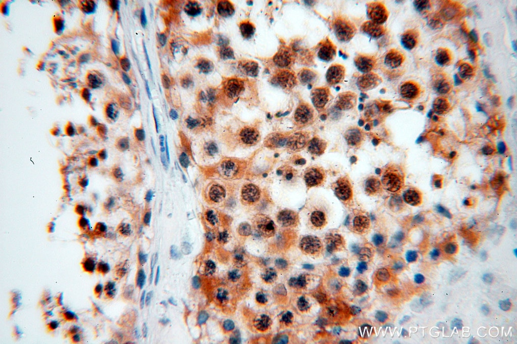 Immunohistochemistry (IHC) staining of human testis tissue using RAN Polyclonal antibody (10469-1-AP)