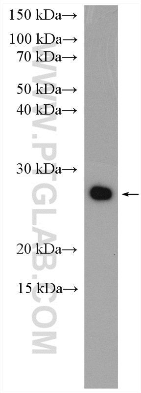 Western Blot (WB) analysis of A375 cells using RAN Polyclonal antibody (10469-1-AP)