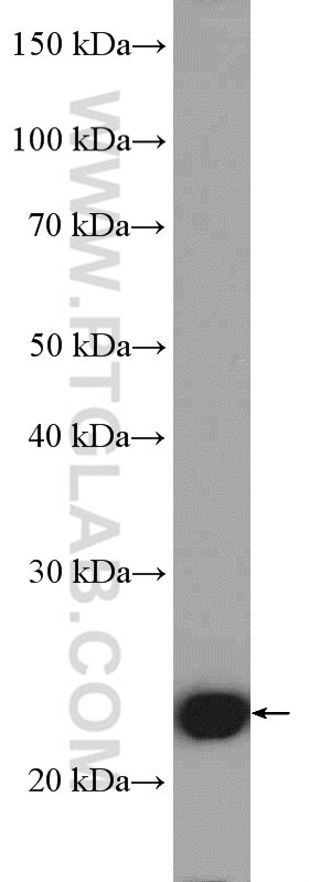 Western Blot (WB) analysis of HEK-293 cells using RAN Polyclonal antibody (10469-1-AP)