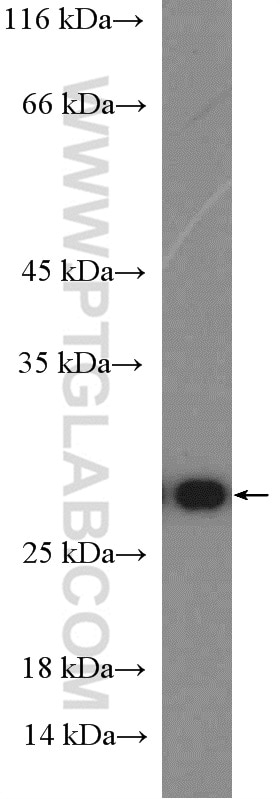 Western Blot (WB) analysis of mouse kidney tissue using RAN Polyclonal antibody (10469-1-AP)