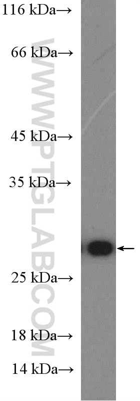 WB analysis of mouse kidney using 10469-1-AP