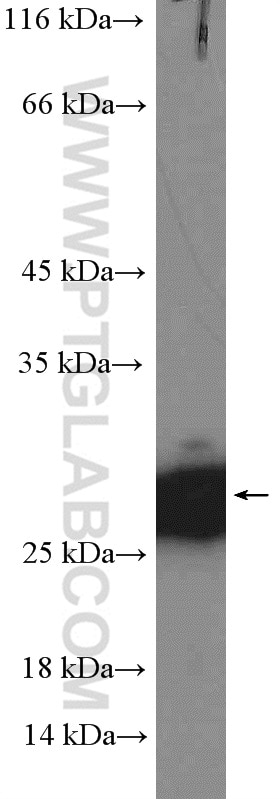 Western Blot (WB) analysis of A375 cells using RAN Polyclonal antibody (10469-1-AP)