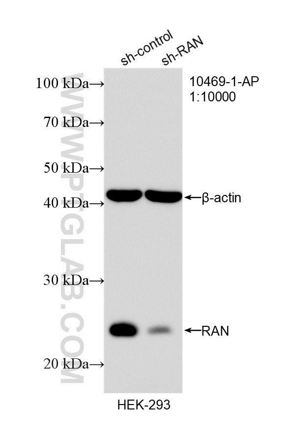Western Blot (WB) analysis of HEK-293 cells using RAN Polyclonal antibody (10469-1-AP)