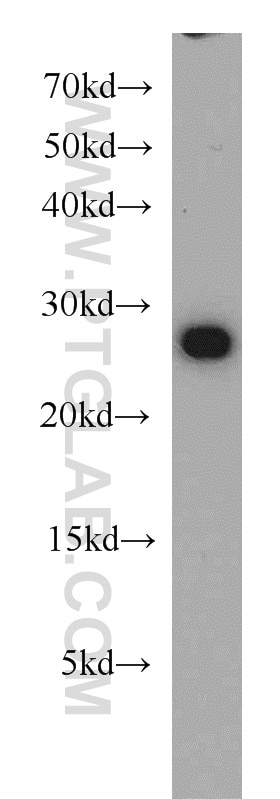 Western Blot (WB) analysis of HeLa cells using RAN Polyclonal antibody (10469-1-AP)
