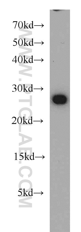 WB analysis of HeLa using 10469-1-AP