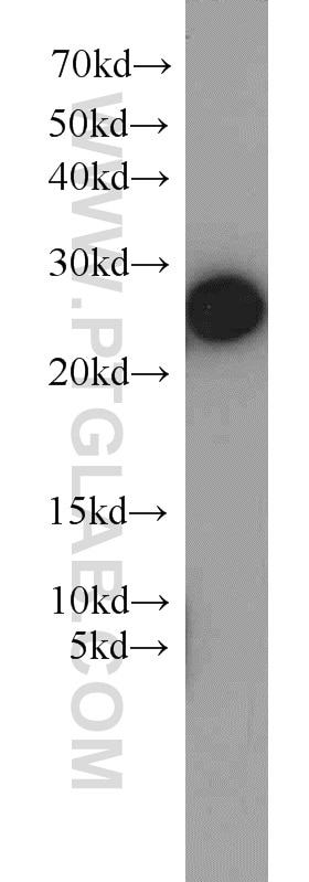 Western Blot (WB) analysis of Jurkat cells using RAN Polyclonal antibody (10469-1-AP)