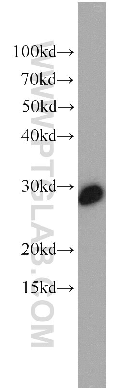 RAN Polyclonal antibody