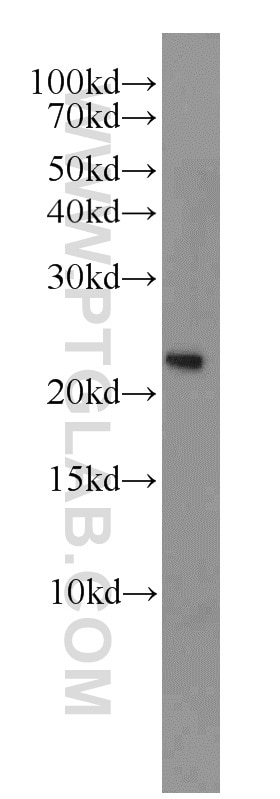 Western Blot (WB) analysis of rat kidney tissue using RAN Polyclonal antibody (10469-1-AP)