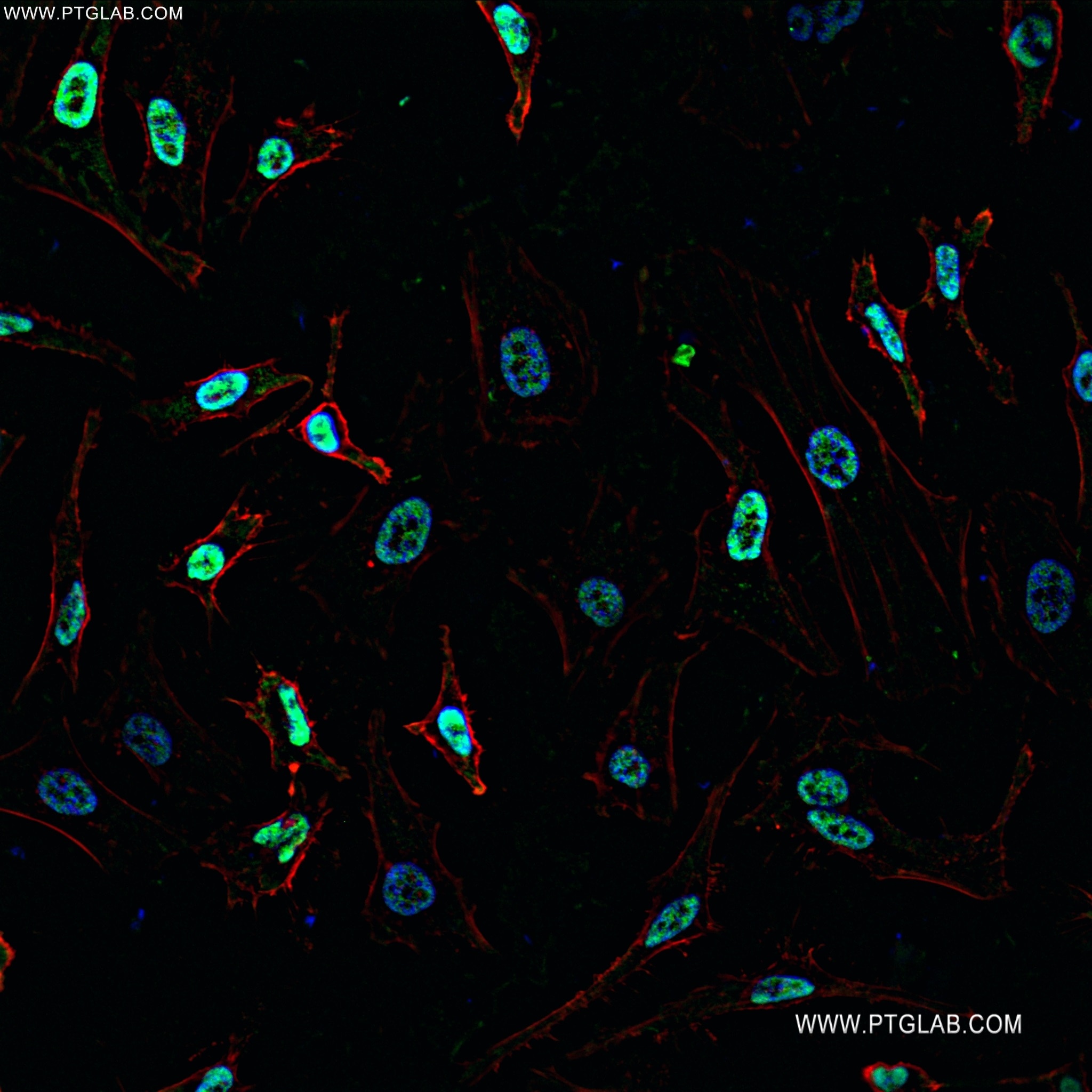 IF Staining of HeLa using 82978-1-RR