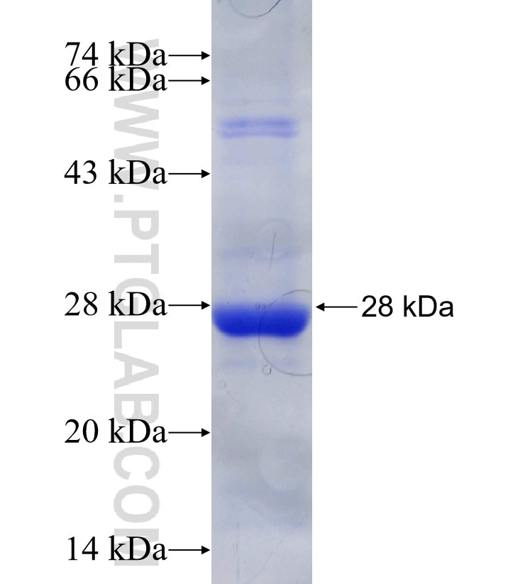 RAN fusion protein Ag30034 SDS-PAGE