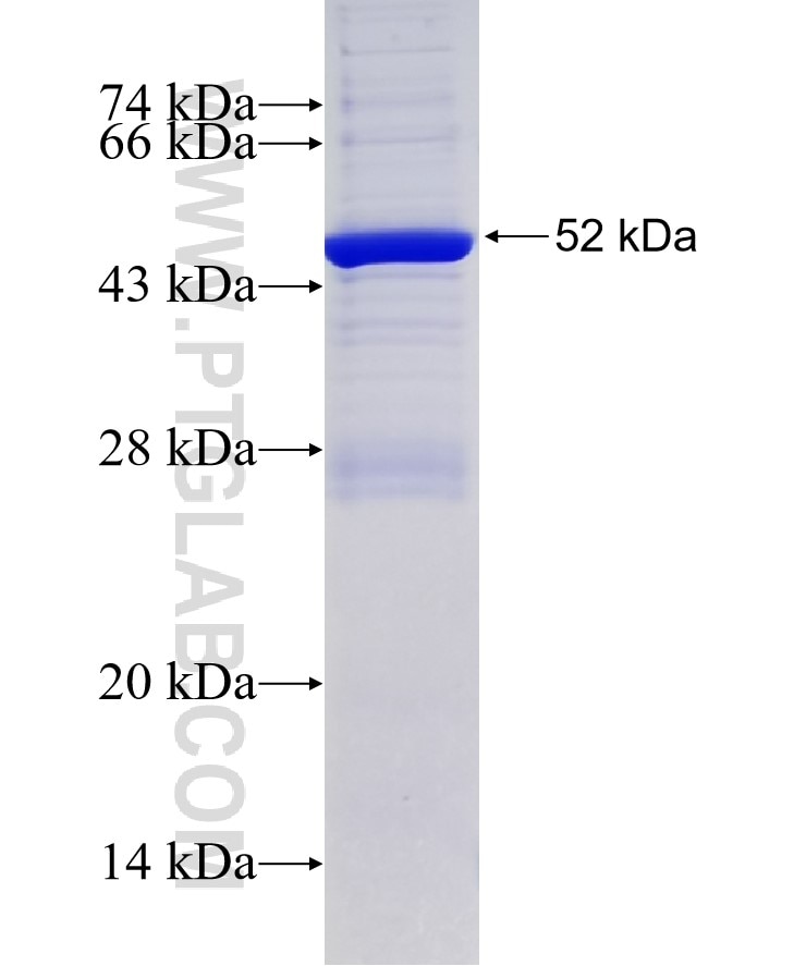 RAN fusion protein Ag0748 SDS-PAGE