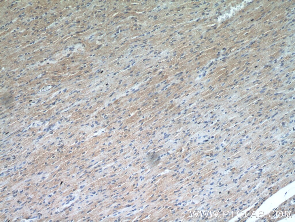 IHC staining of human heart using 21107-1-AP