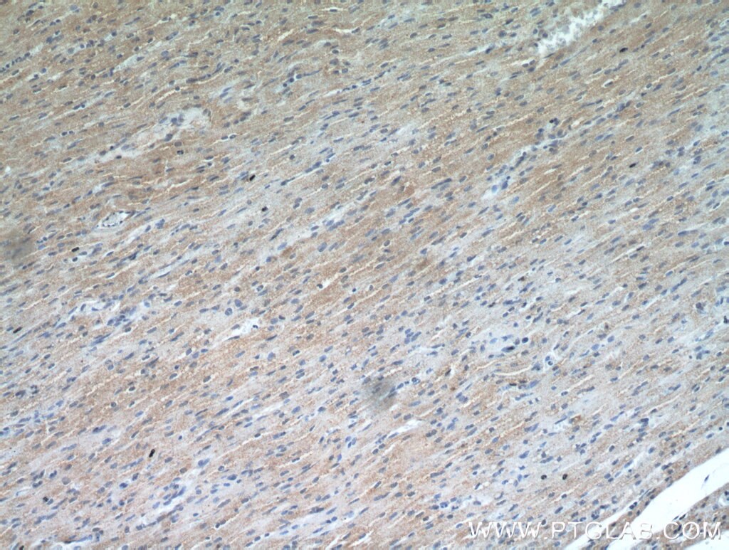 Immunohistochemistry (IHC) staining of human heart tissue using RANBP10 Polyclonal antibody (21107-1-AP)