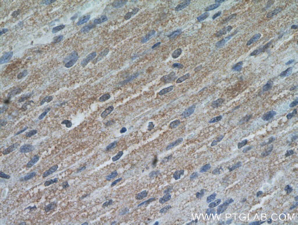 Immunohistochemistry (IHC) staining of human heart tissue using RANBP10 Polyclonal antibody (21107-1-AP)