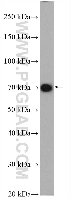 Western Blot (WB) analysis of mouse brain tissue using RANBP10 Polyclonal antibody (21107-1-AP)