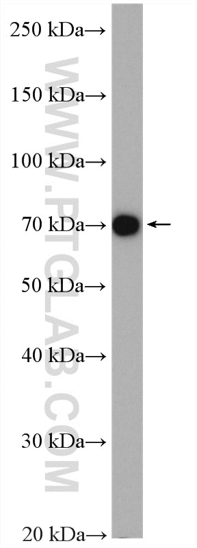 Western Blot (WB) analysis of mouse heart tissue using RANBP10 Polyclonal antibody (21107-1-AP)