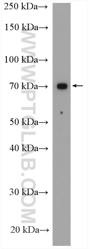 Western Blot (WB) analysis of LNCaP cells using RANBP10 Polyclonal antibody (21107-1-AP)