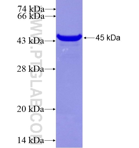 RANBP10 fusion protein Ag15387 SDS-PAGE