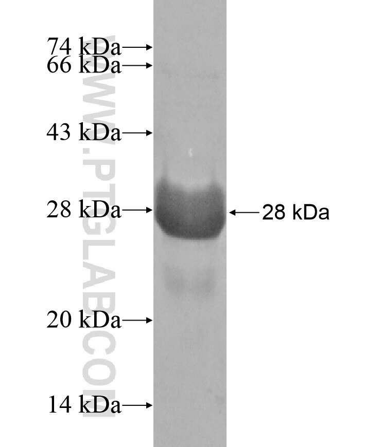 RANBP10 fusion protein Ag17145 SDS-PAGE