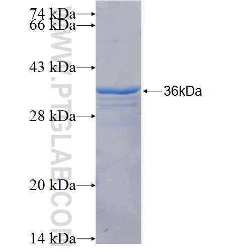 RANBP2 fusion protein Ag26370 SDS-PAGE