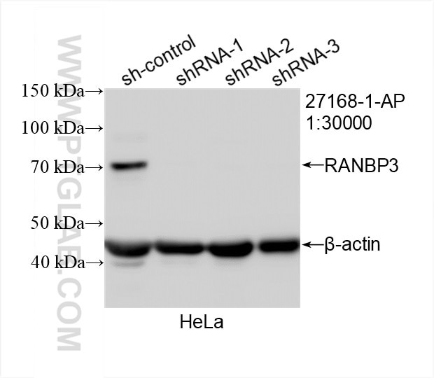 Western Blot (WB) analysis of Jurkat cells using RANBP3 Polyclonal antibody (27168-1-AP)