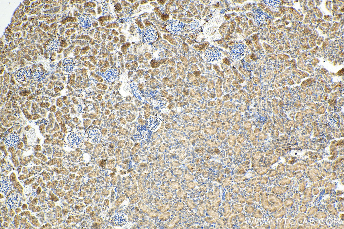 Immunohistochemistry (IHC) staining of mouse kidney tissue using RANBP3L Polyclonal antibody (17875-1-AP)