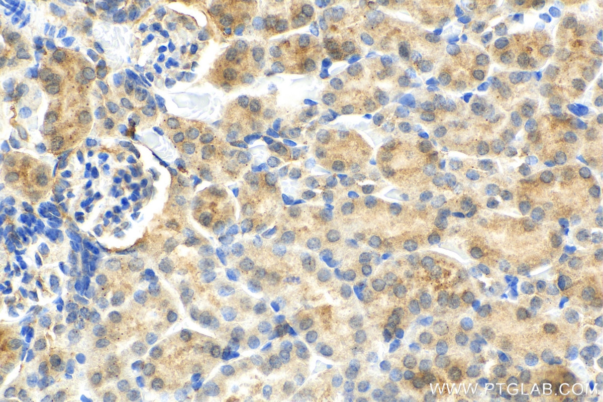 Immunohistochemistry (IHC) staining of mouse kidney tissue using RANBP3L Polyclonal antibody (17875-1-AP)