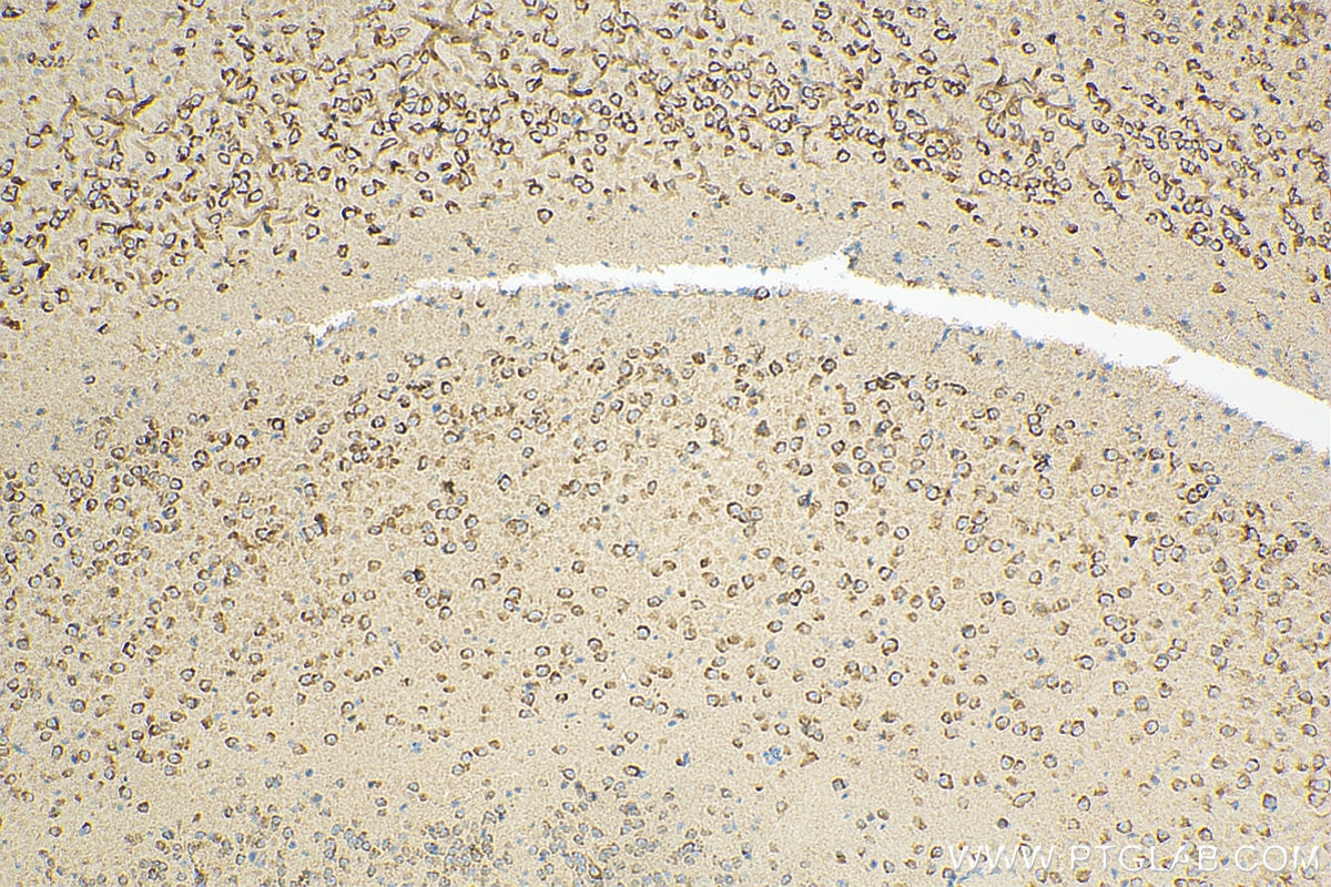 Immunohistochemistry (IHC) staining of mouse brain tissue using RANBP3L Polyclonal antibody (17875-1-AP)