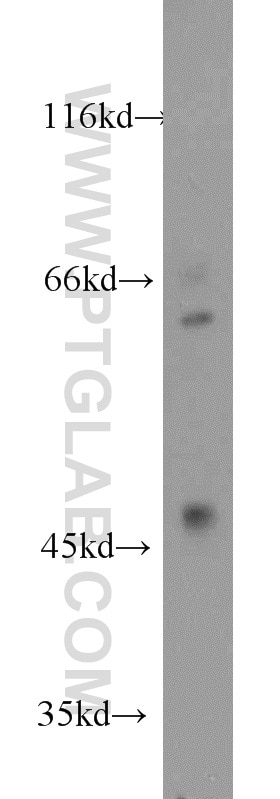 Western Blot (WB) analysis of Jurkat cells using RANBP3L Polyclonal antibody (17875-1-AP)