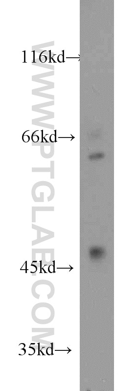 WB analysis of Jurkat using 17875-1-AP