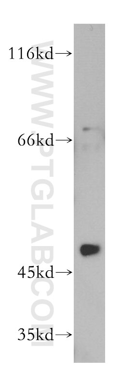 Western Blot (WB) analysis of Jurkat cells using RANBP3L Polyclonal antibody (17875-1-AP)