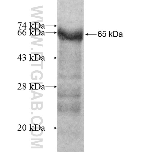 RANBP3L fusion protein Ag11519 SDS-PAGE RANBP3L fusion protein Ag11519 SDS-PAGE