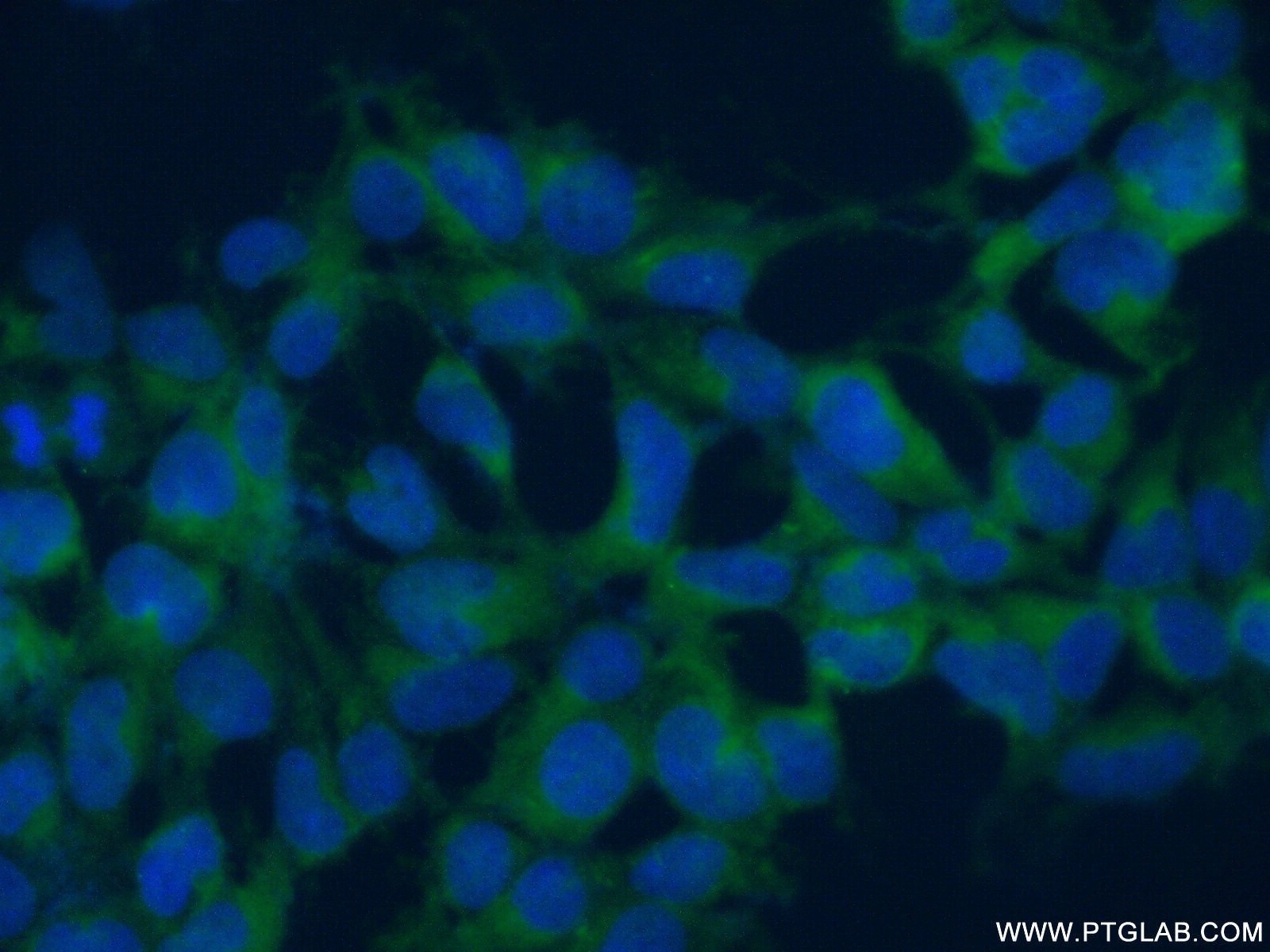 Immunofluorescence (IF) / fluorescent staining of HEK-293 cells using RANBP6 Polyclonal antibody (17656-1-AP)