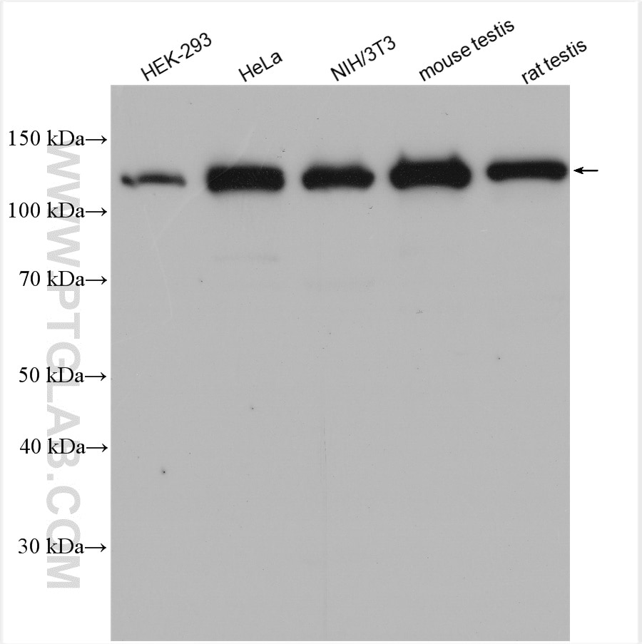 Western Blot (WB) analysis of various lysates using RANBP6 Polyclonal antibody (17656-1-AP)