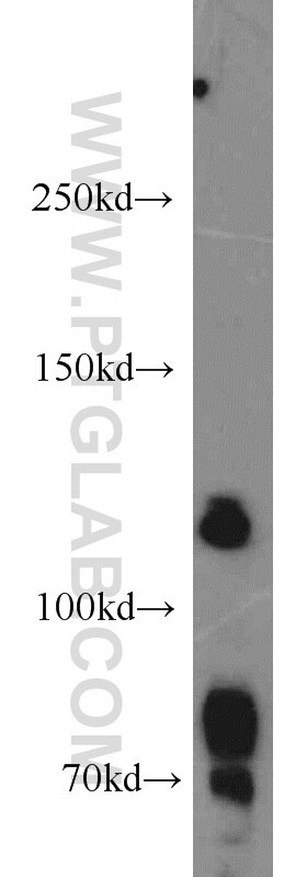 Western Blot (WB) analysis of mouse skeletal muscle tissue using RANBP6 Polyclonal antibody (17656-1-AP)