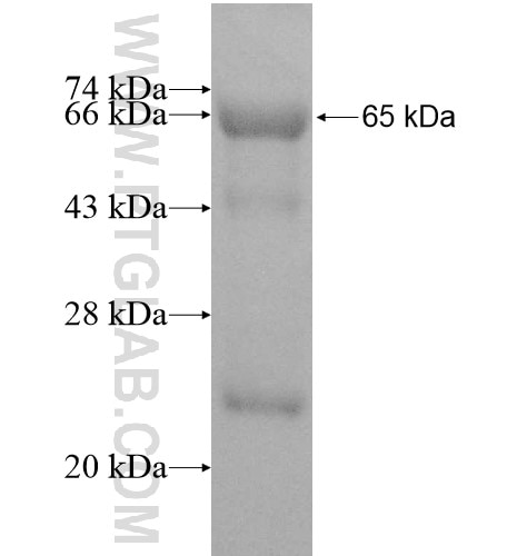 RANBP6 fusion protein Ag11906 SDS-PAGE