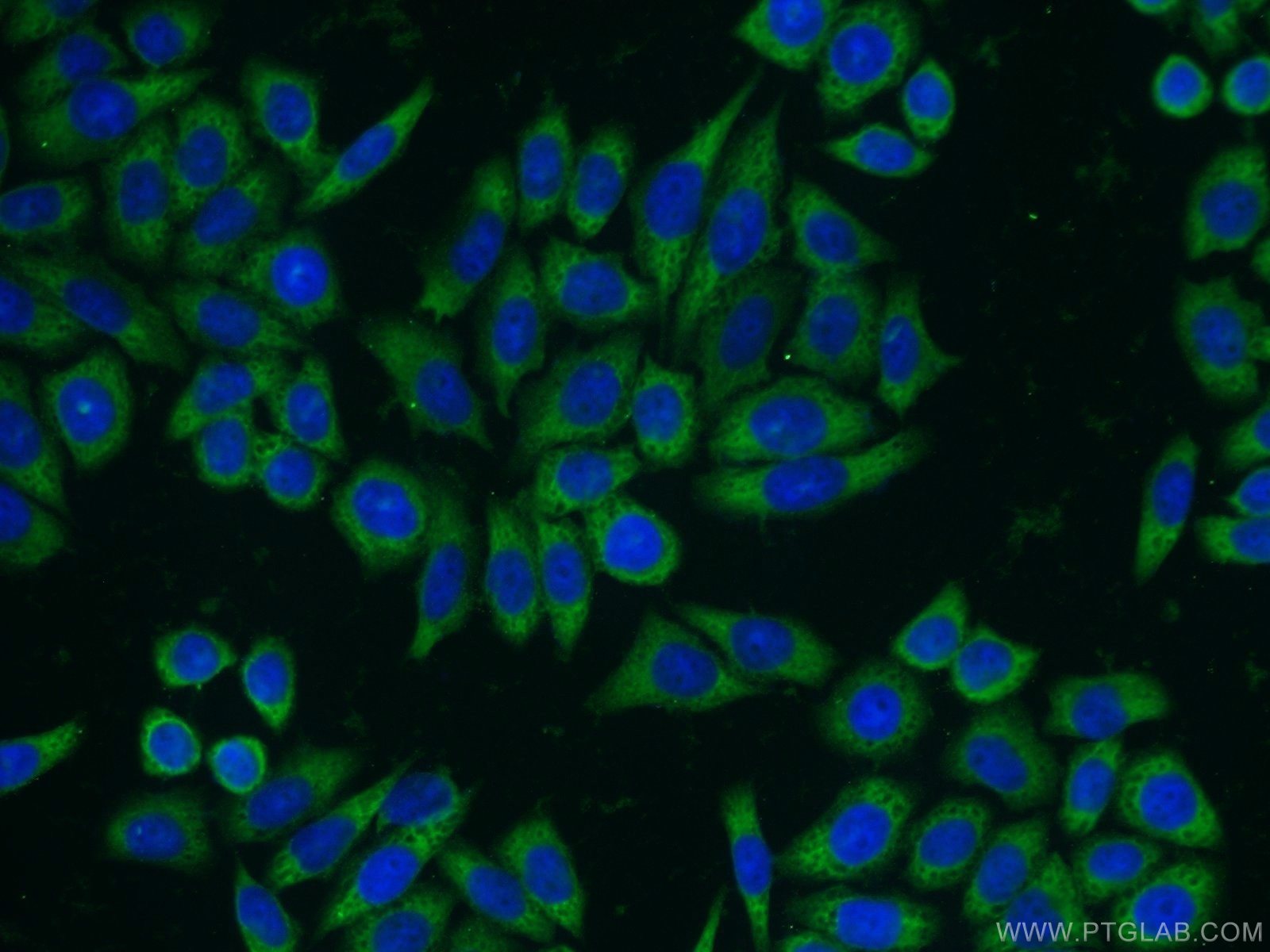 Immunofluorescence (IF) / fluorescent staining of HeLa cells using RANBP9 Polyclonal antibody (17755-1-AP)