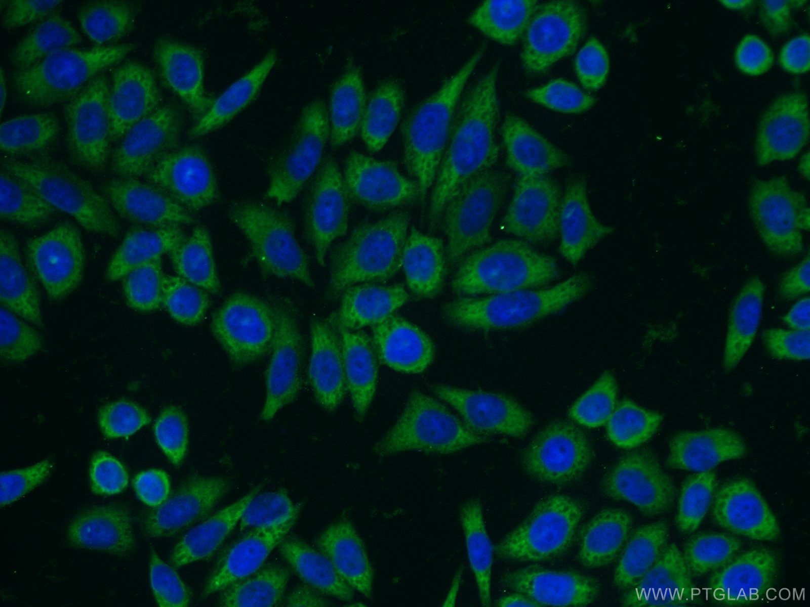 IF Staining of HeLa using 17755-1-AP