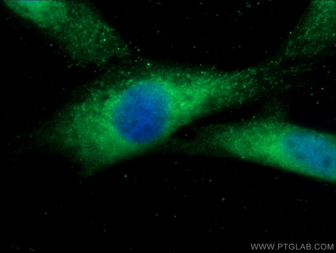 Immunofluorescence (IF) / fluorescent staining of MDCK cells using RANBP9 Polyclonal antibody (17755-1-AP)
