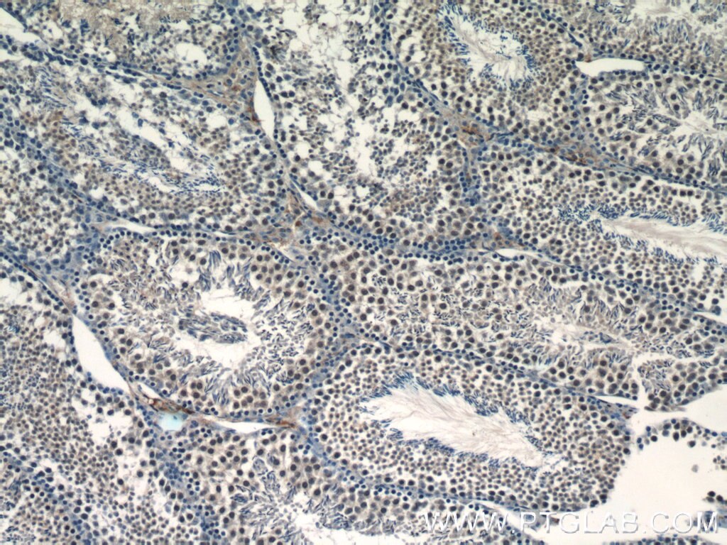 Immunohistochemistry (IHC) staining of mouse testis tissue using RANBP9 Polyclonal antibody (17755-1-AP)