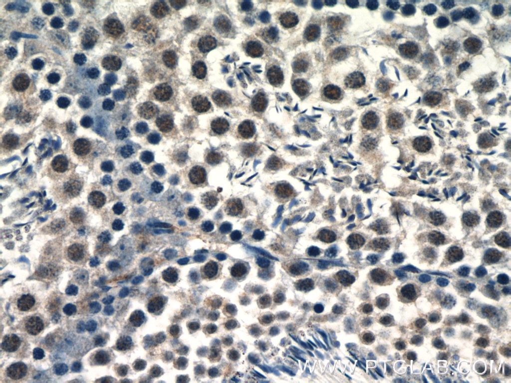 Immunohistochemistry (IHC) staining of mouse testis tissue using RANBP9 Polyclonal antibody (17755-1-AP)