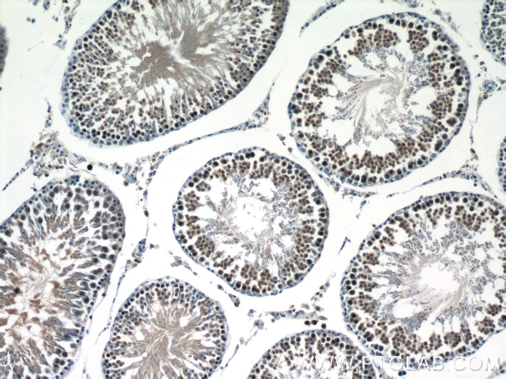 Immunohistochemistry (IHC) staining of rat testis tissue using RANBP9 Polyclonal antibody (17755-1-AP)